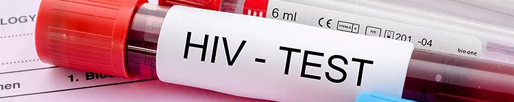 Анализы на ВИЧ в Перово
